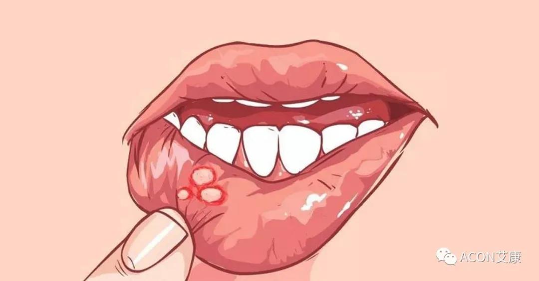 哪些小病容易讓人忽視，最后造成越拖越嚴(yán)重呢？