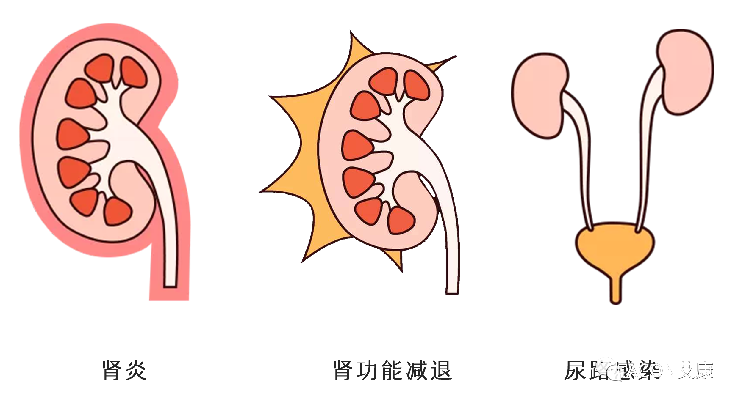 排尿黃、異味大，可能是身體在報警！