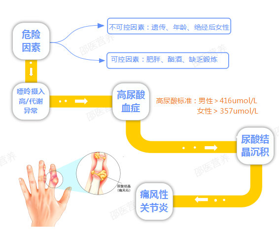痛風(fēng)為什么偏愛男性？你最關(guān)心的問題都在這里