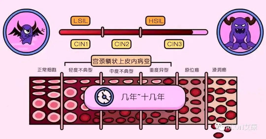 全球首次承諾消除一種癌癥，預(yù)計到2050年將挽救500萬人的生命
