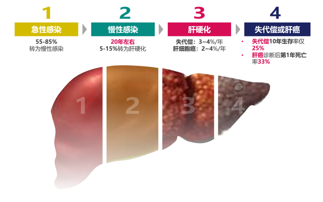 悄悄變成肝硬化、肝癌，很多人感染了卻不知道