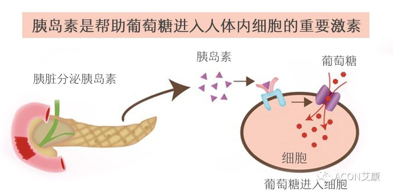 爆上熱搜，因爆發(fā)型糖尿病進(jìn)入ICU，有哪些教訓(xùn)值得我們汲取